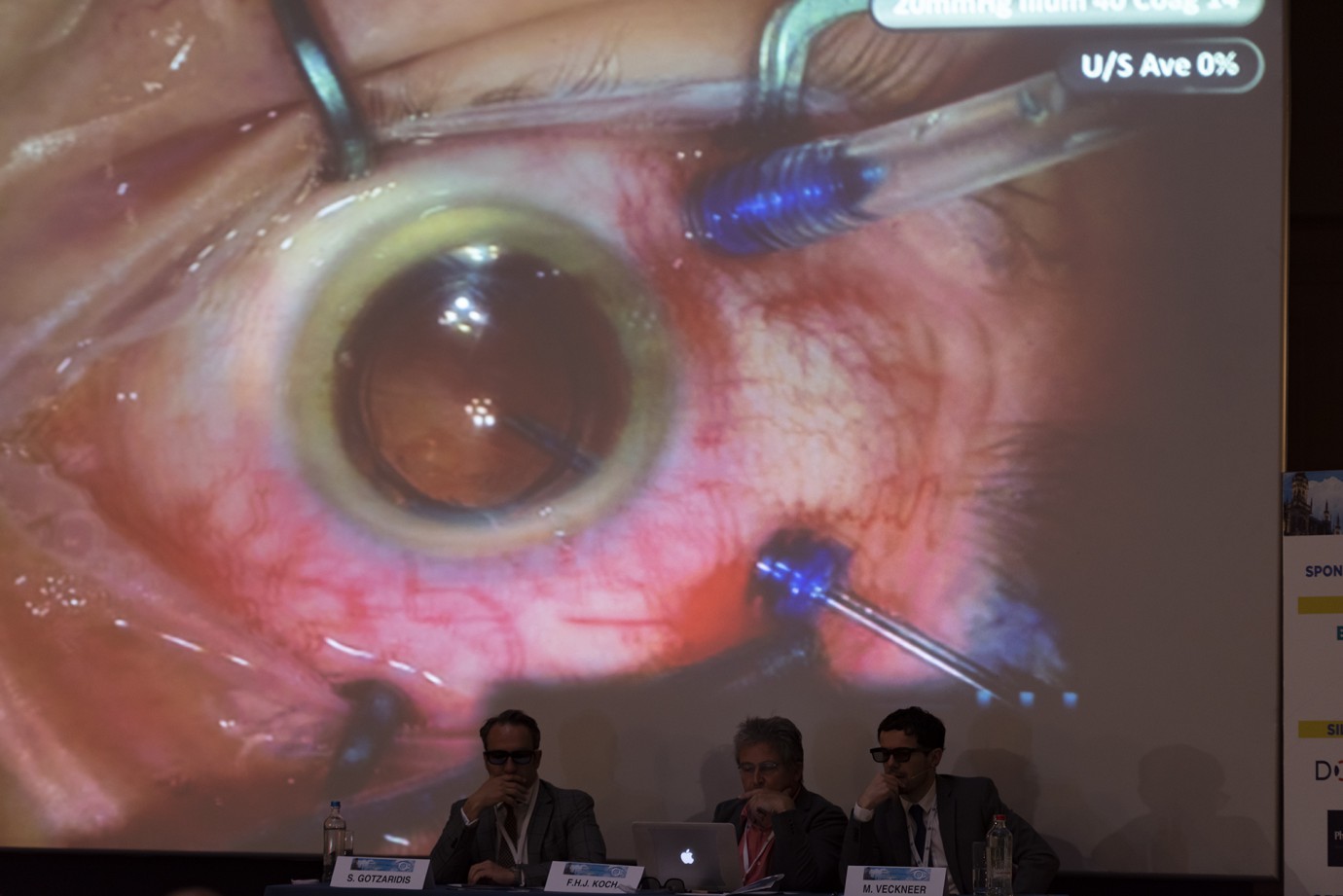 Brussels Retina Meeting 2019 / live surgery 3D projection